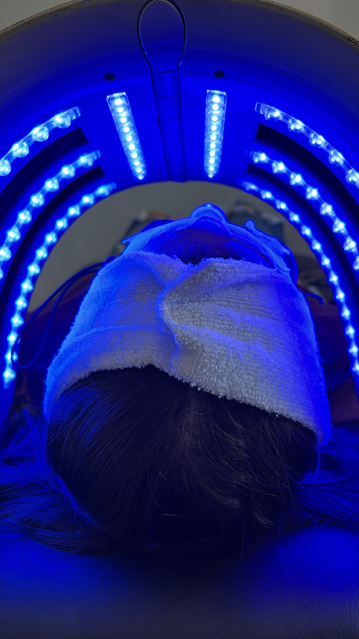 Imagem do serviço de Avaliação capilar e facial