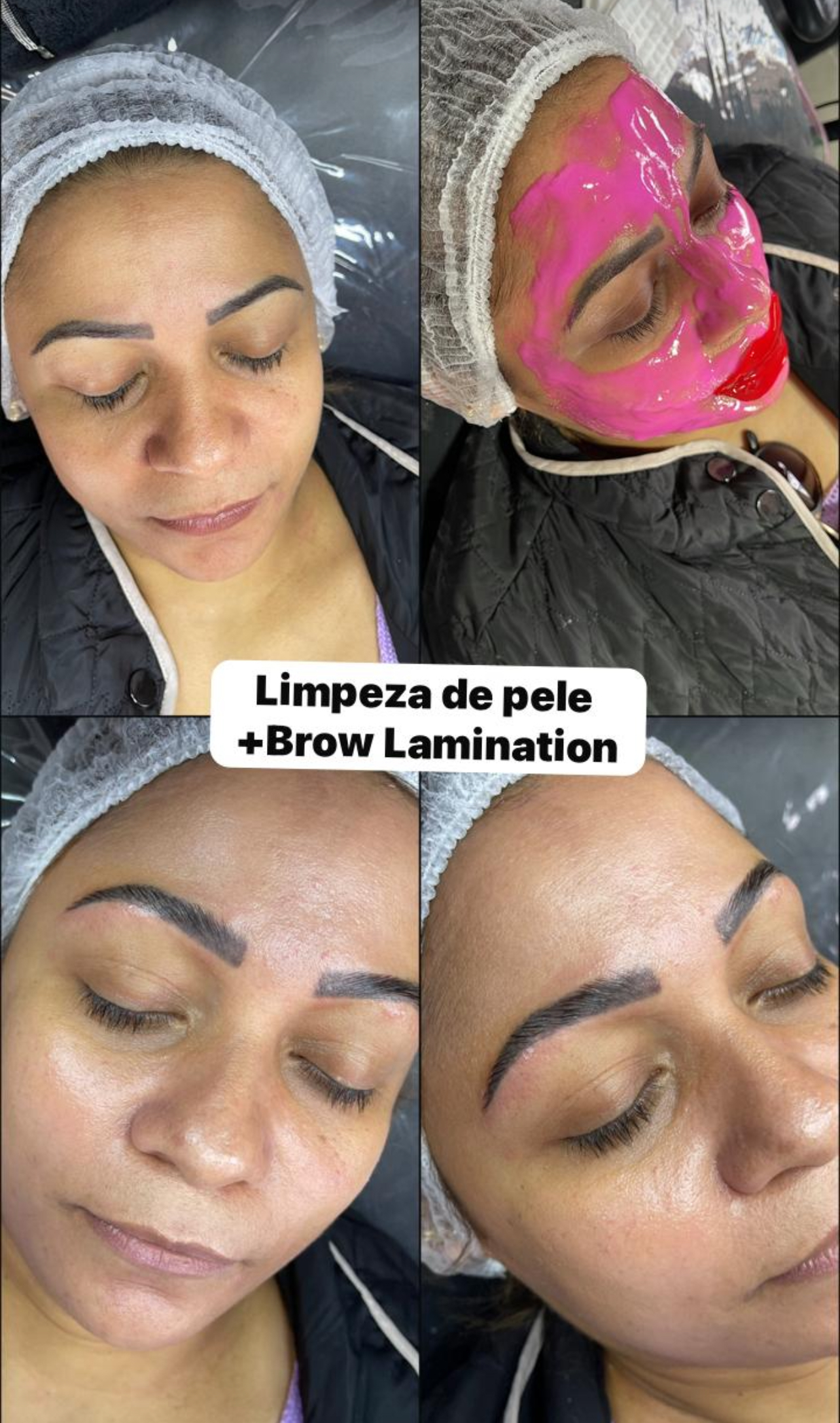 Imagem do serviço de Limpeza de Pele