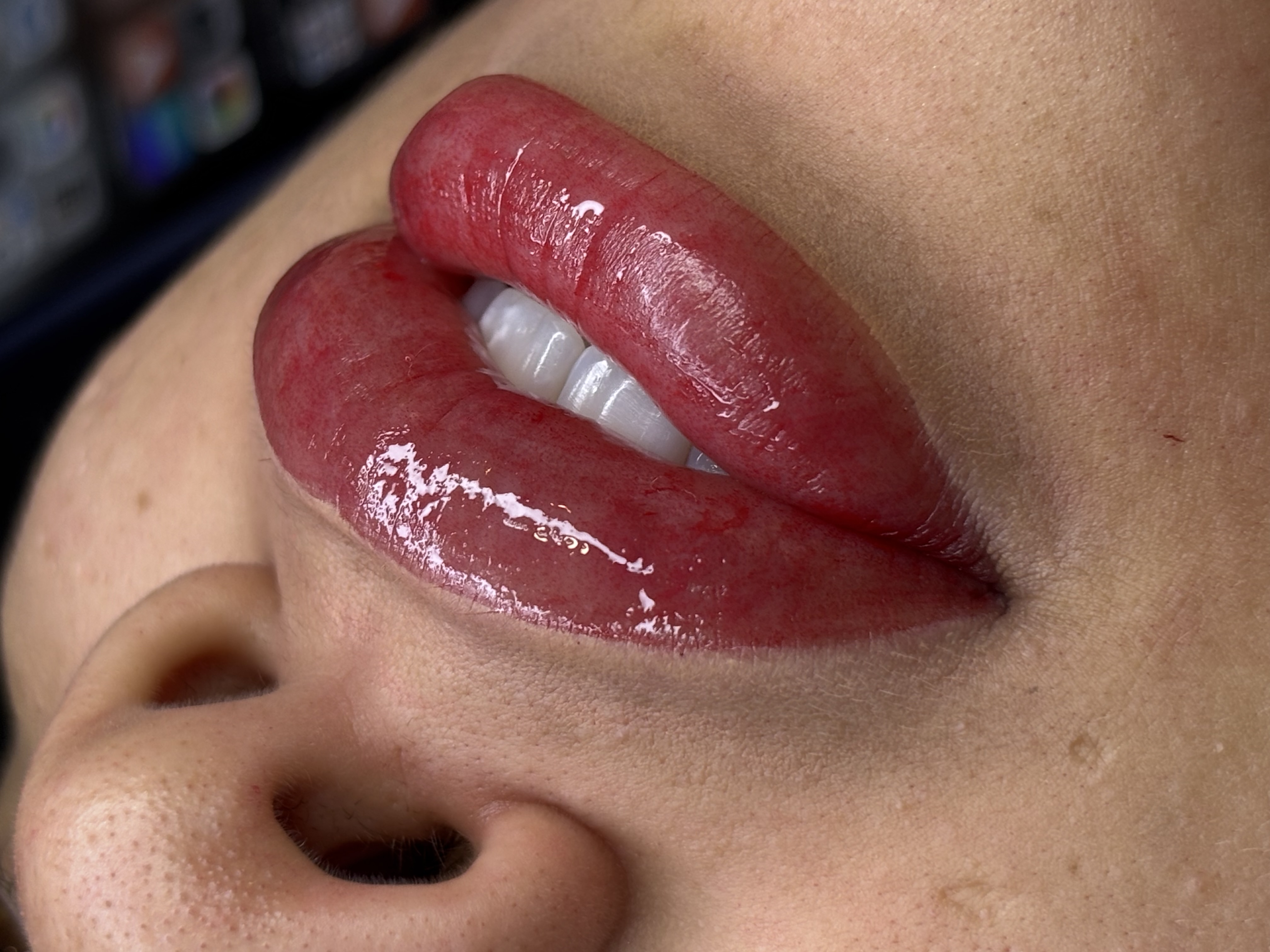 Imagem do serviço de Micropigmentação Labial