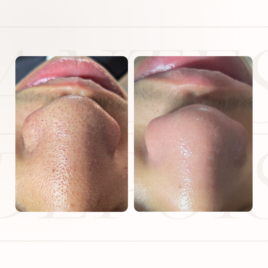 Combo luxo 2 - imagem 3