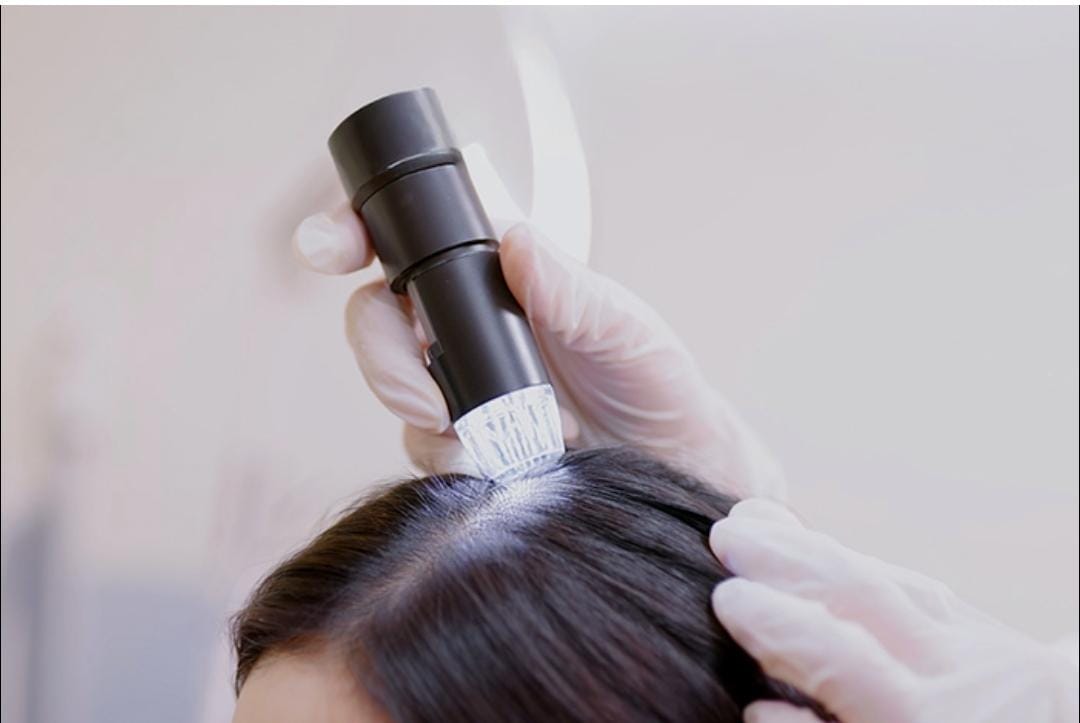 Imagem do serviço de ANALISE CAPILAR  OU TESTE DE MECHAS