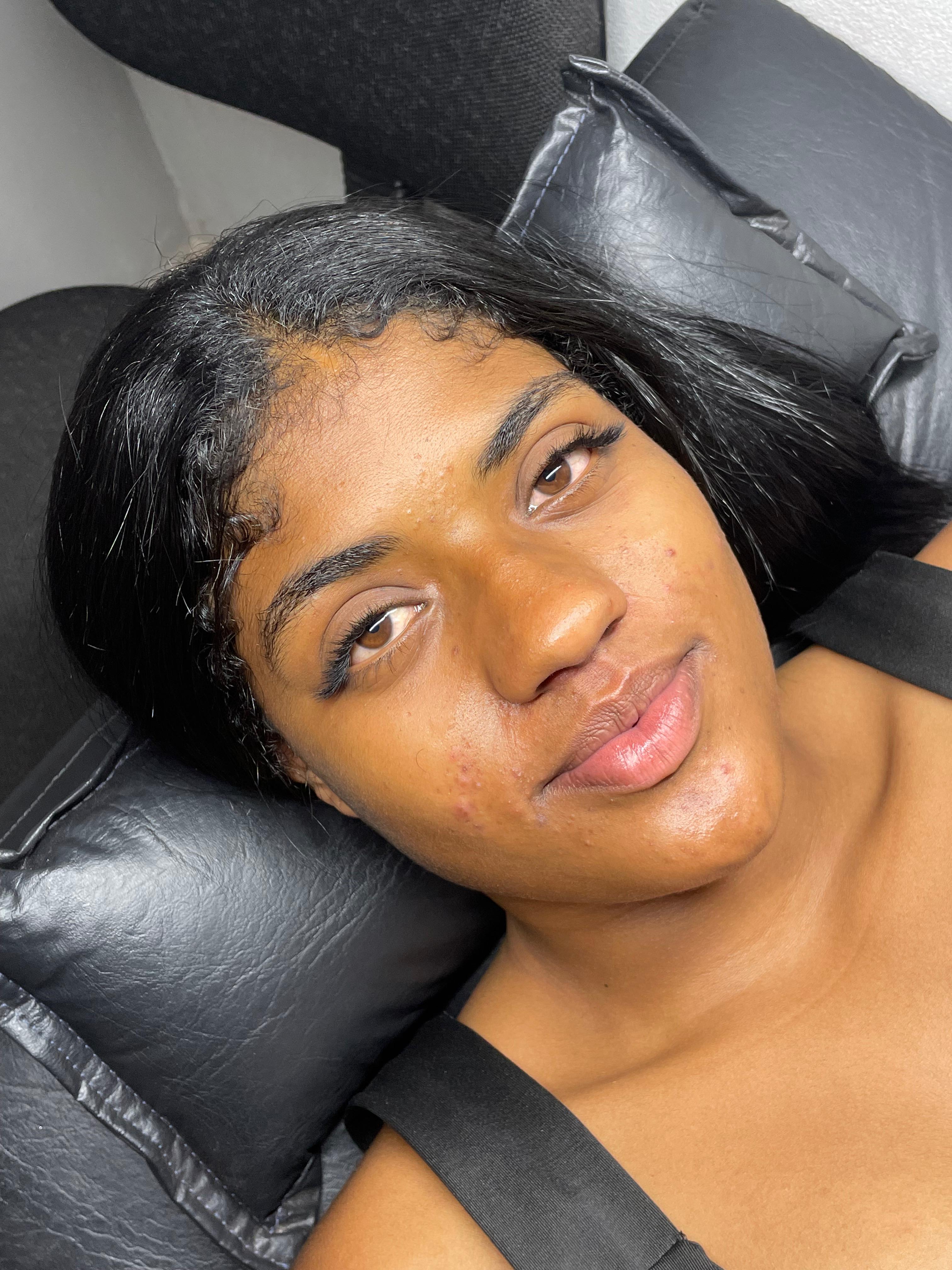 Imagem do serviço de Volume serena