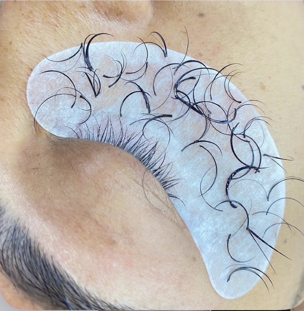 Imagem do serviço de Remoção química