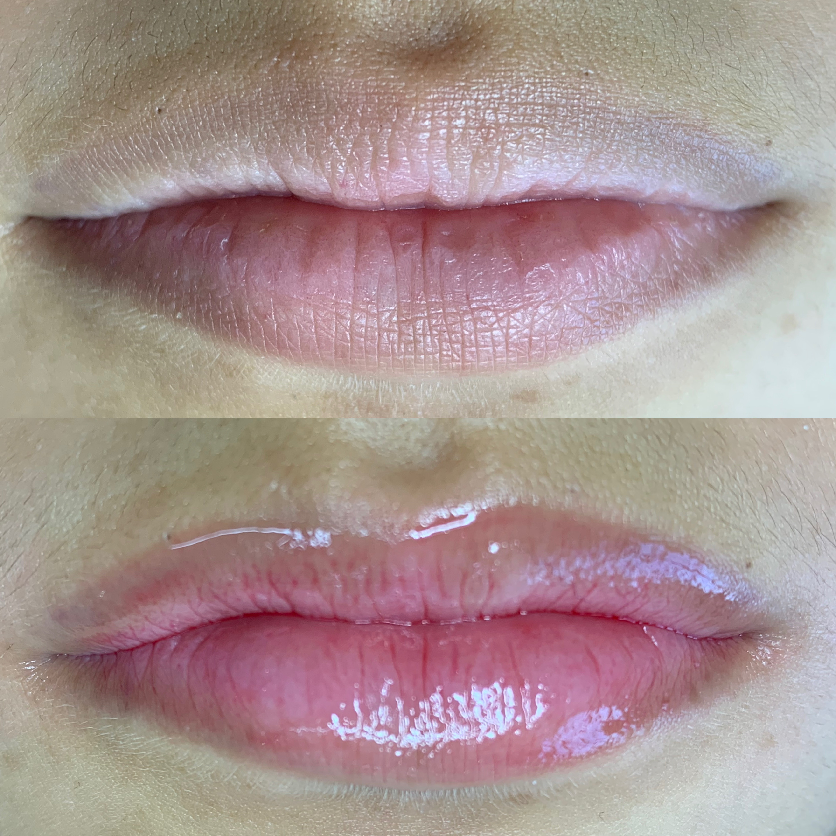 Imagem do serviço de Hidragloss