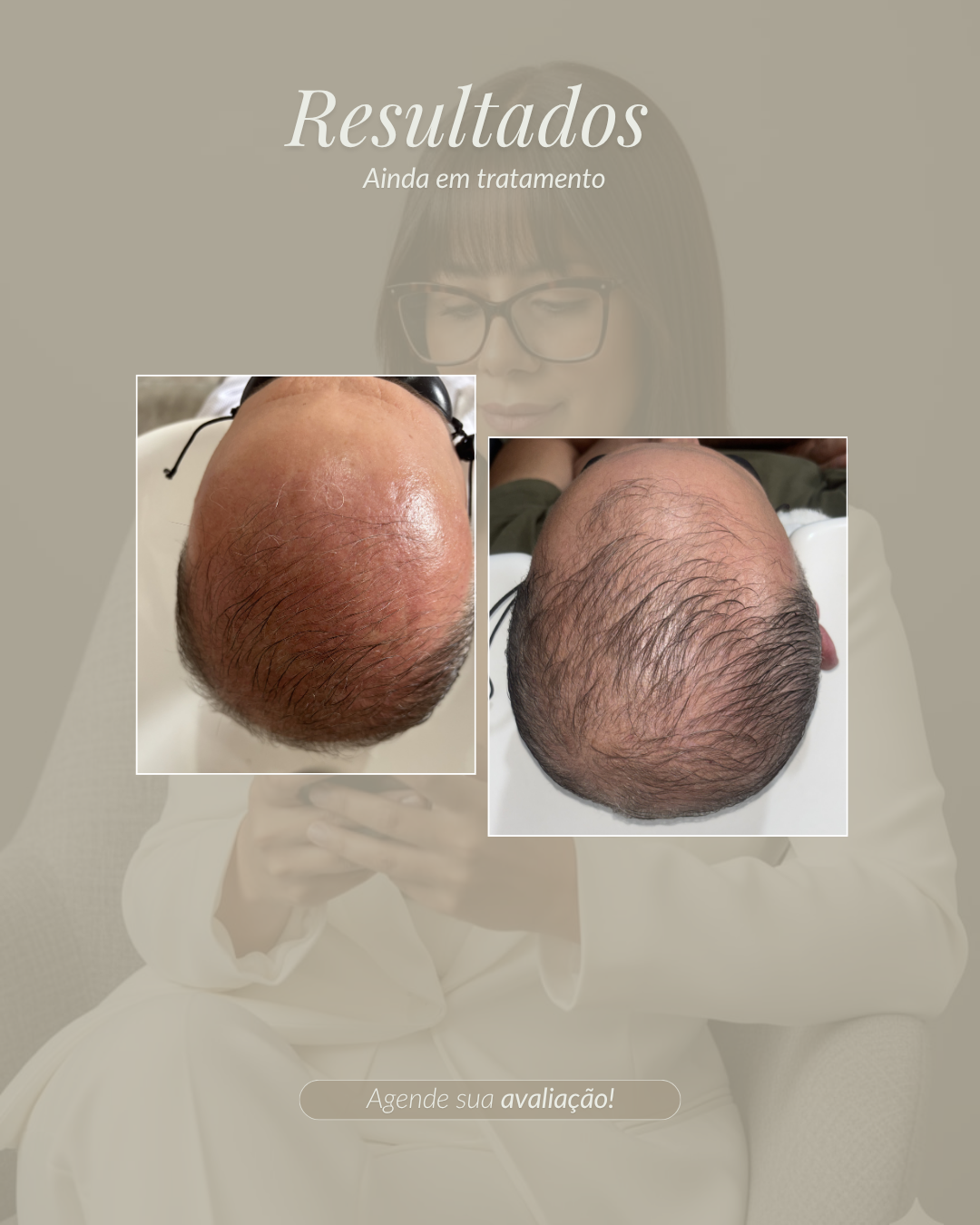 Combo luxo 2 - imagem 2