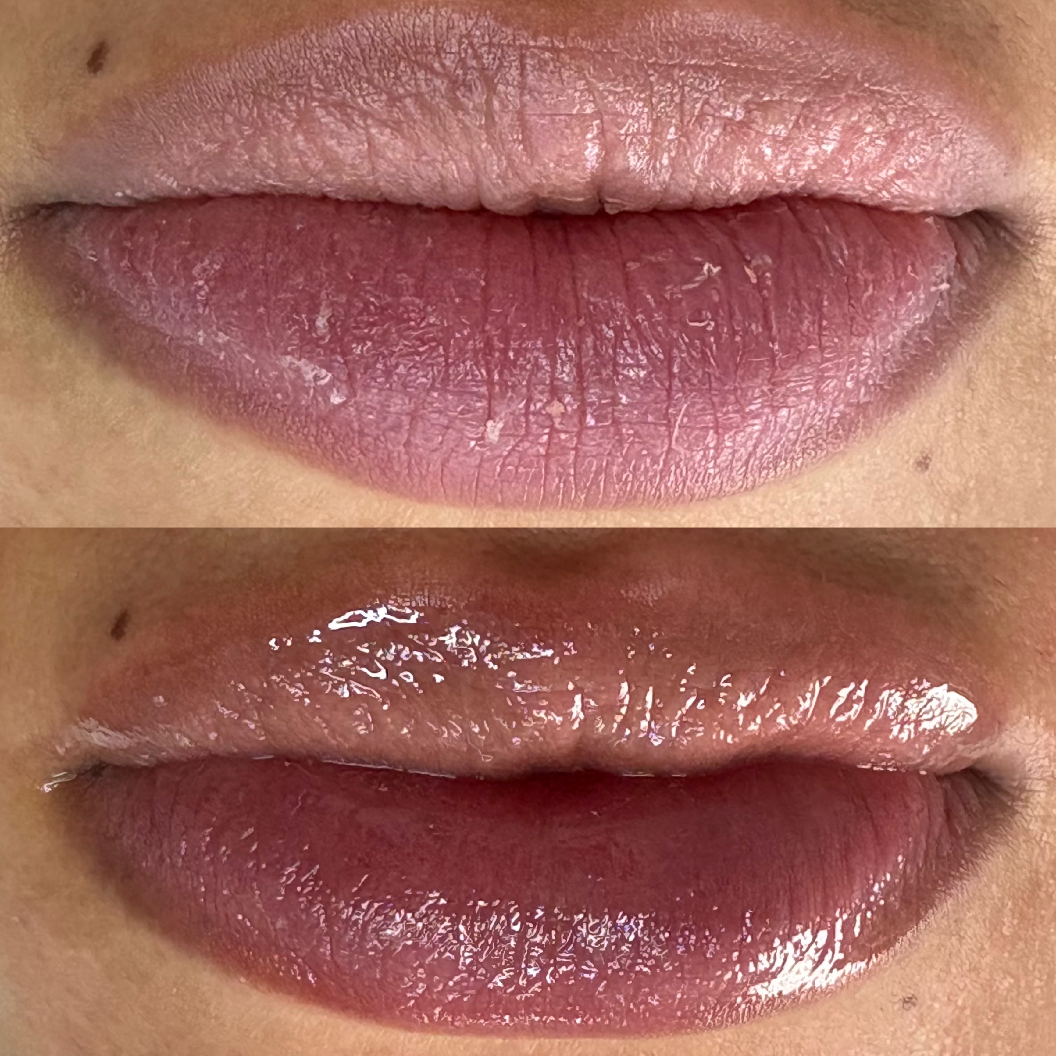 Imagem do serviço de Spa Labial