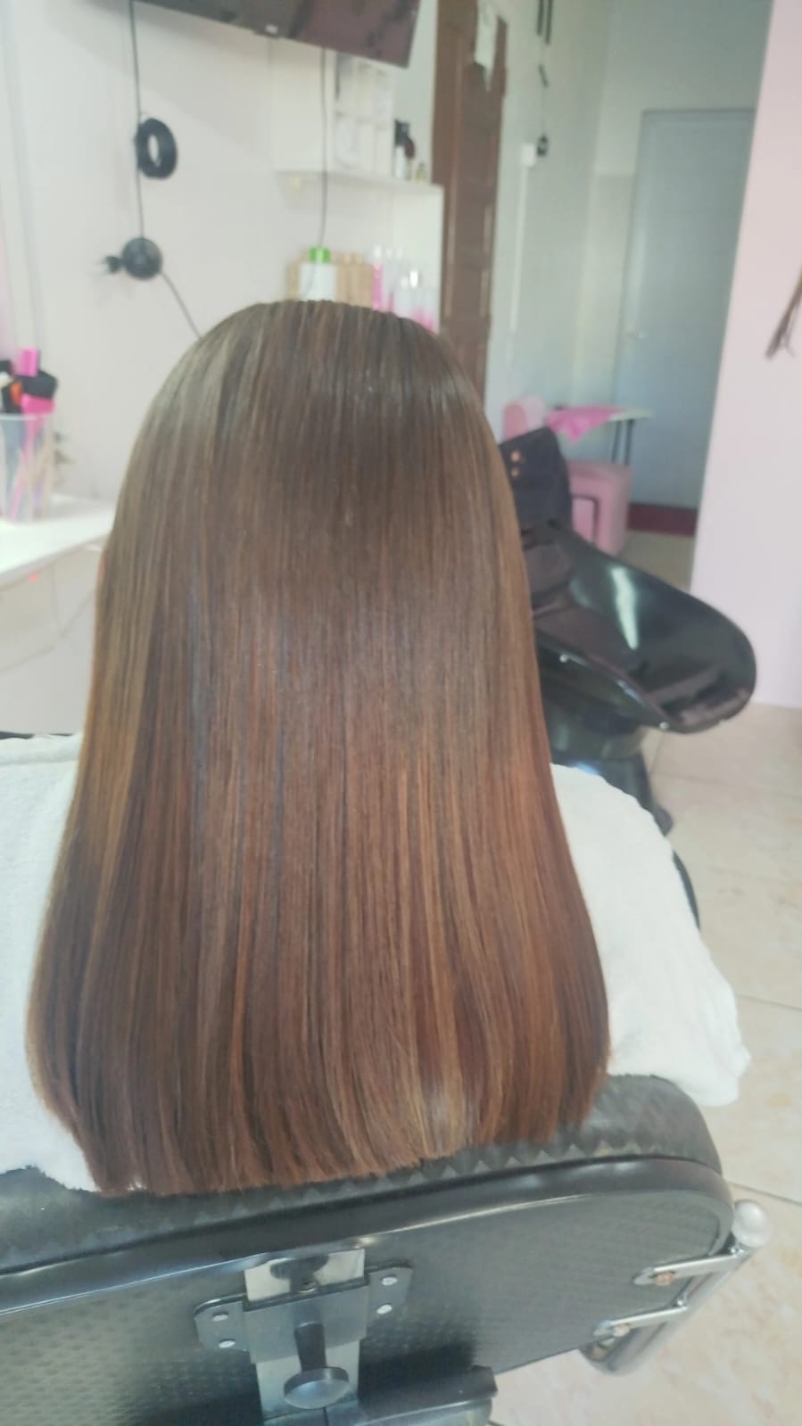 Imagem do serviço de Botox especial