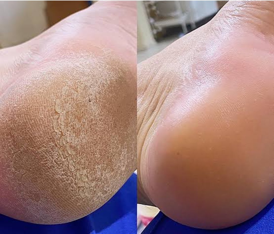 Imagem do serviço de SPA dos pés