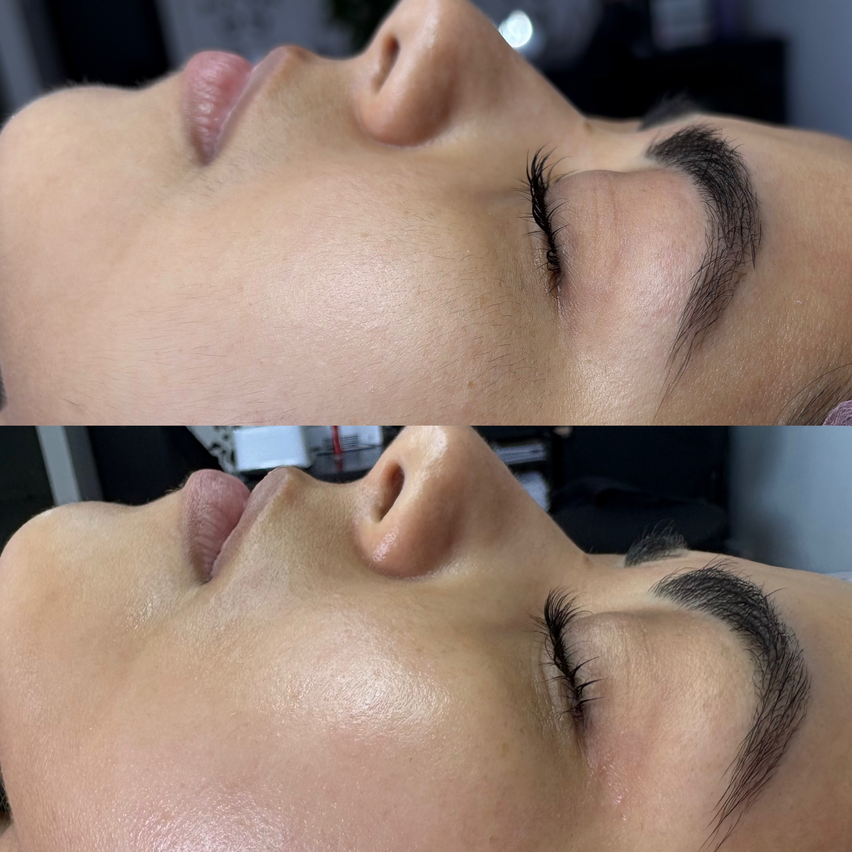 Imagem do serviço de Inova Duster Power Lifthing