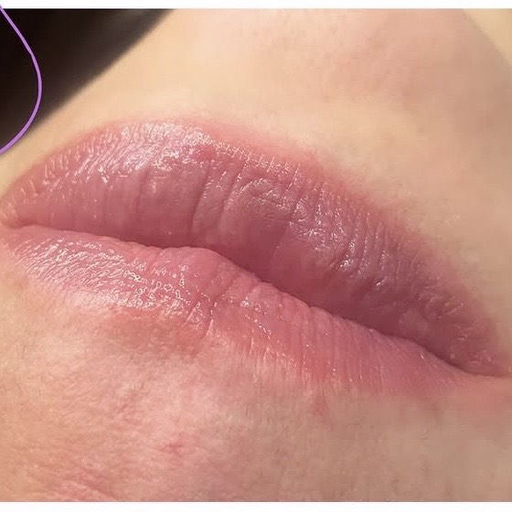 Spa dos labios