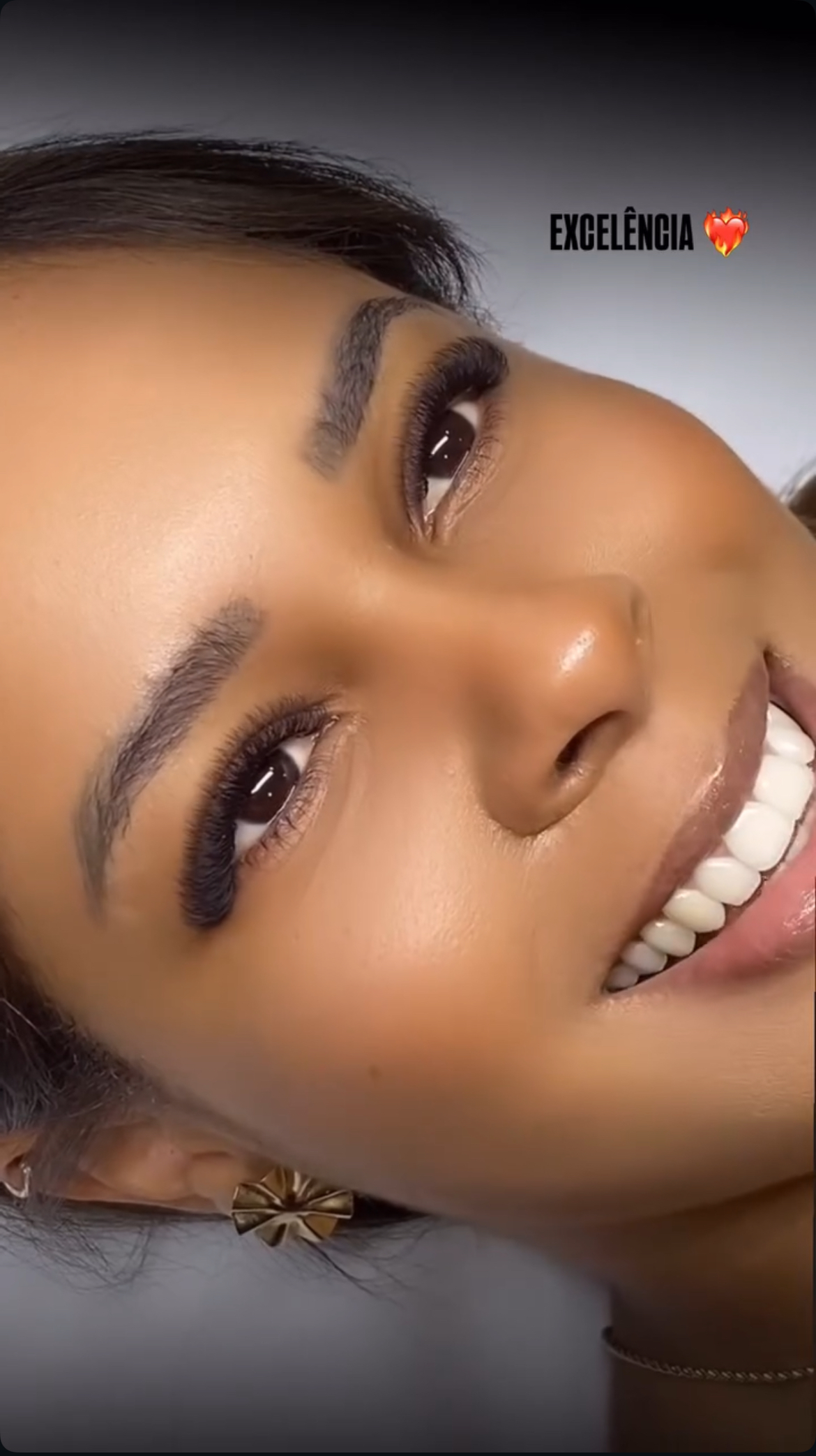 Imagem do serviço de Remoção + Nova aplicação