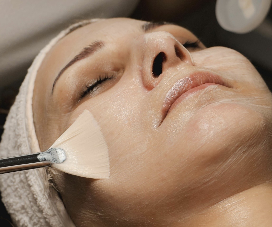 Imagem do serviço de Pelling químico