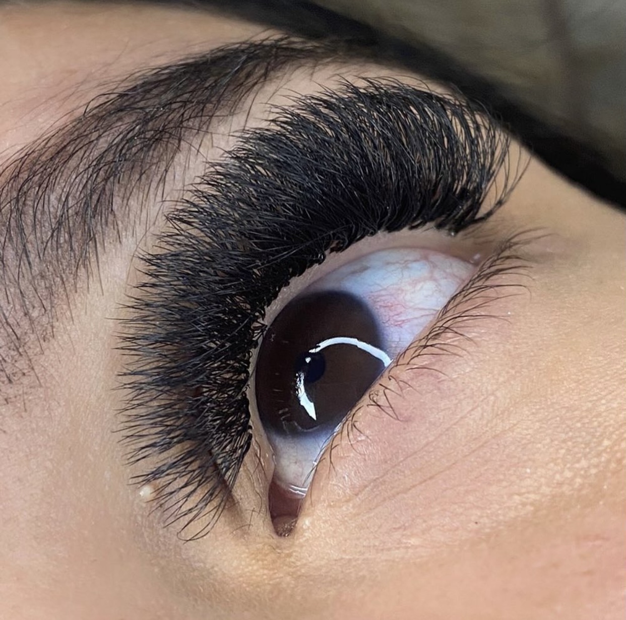 Imagem do serviço de Volume Ester