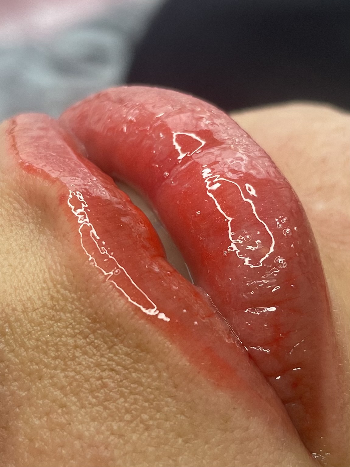 Imagem do serviço de Hidra Gloss labial