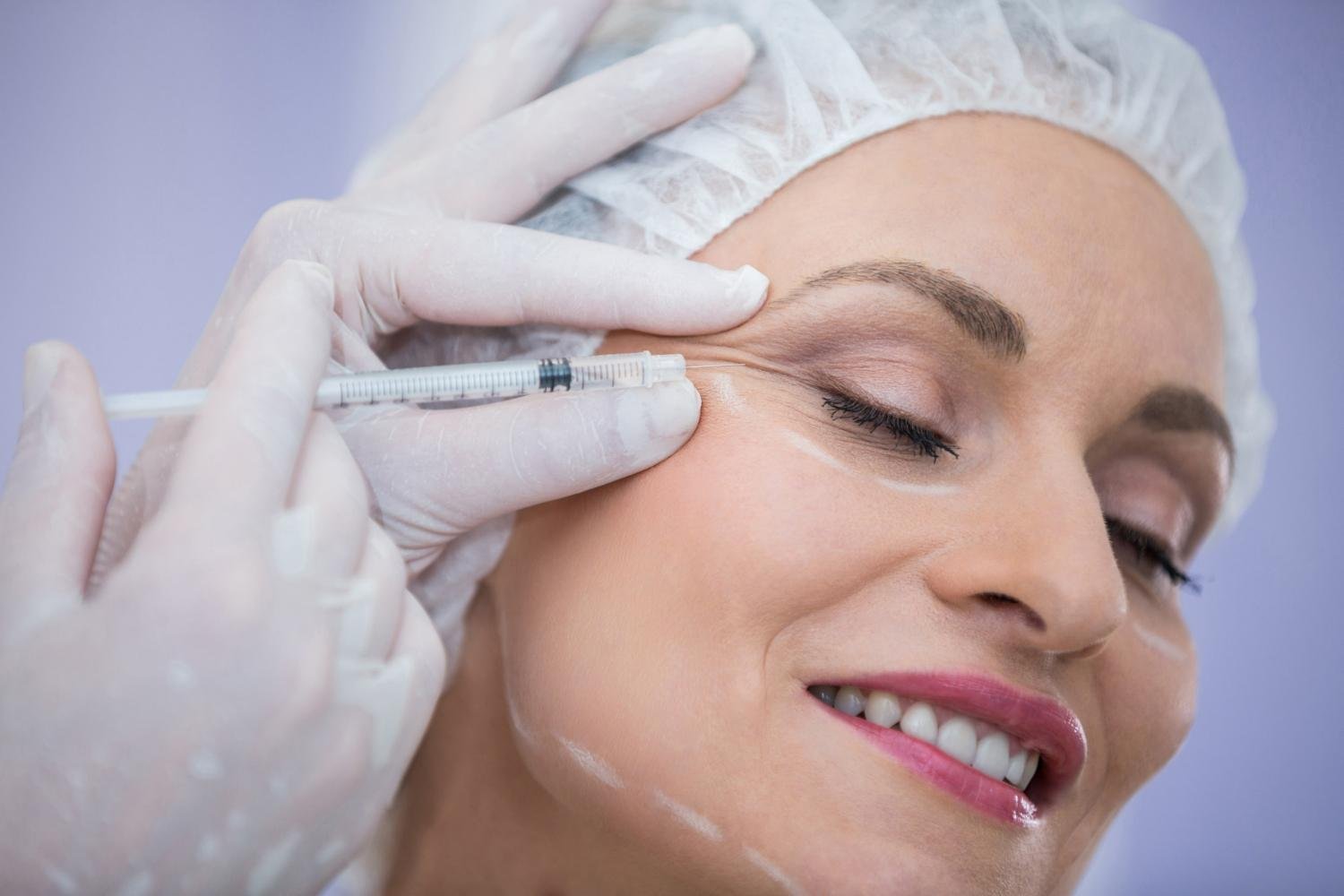 Imagem do serviço de Bioestimulador Facial Sculptra