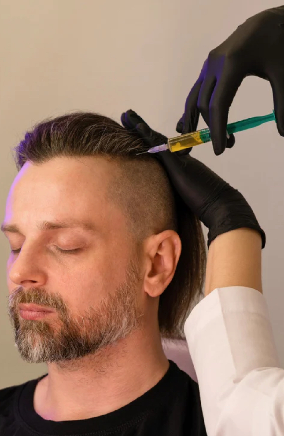 Imagem do serviço de Aplicação Capilar