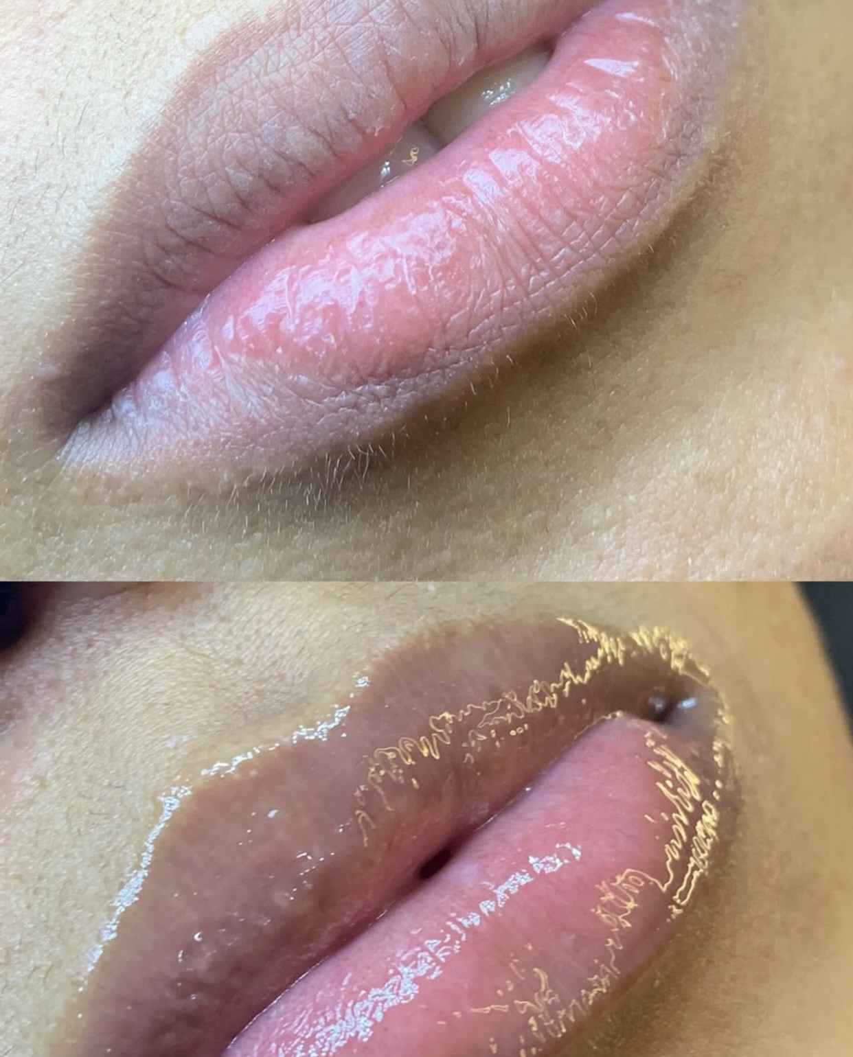 Imagem do serviço de Spa Labial