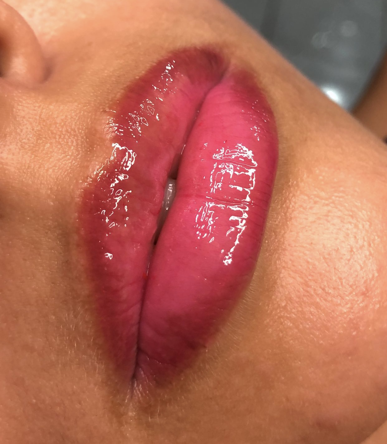 Imagem do serviço de Spa labial